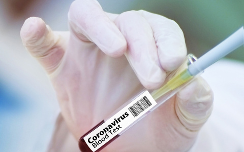 Вакцина от COVID-19: кто получит препарат в первую очередь