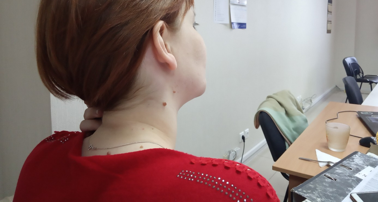 В древности таких людей считали богами: проверьте родинку в этом месте