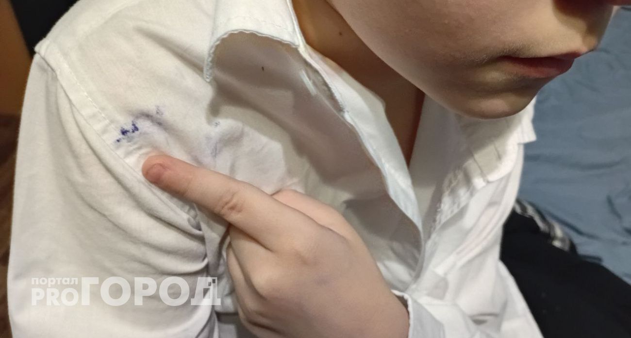 Одно простое средство с кухни в два счета смоет пятна от ручки с белой рубашки: есть у всех