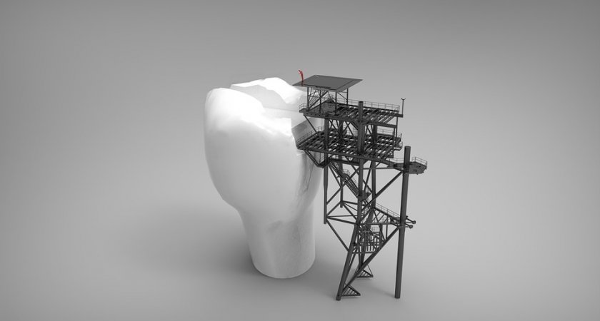 Имплантаты AnyRidge – новое слово в технологии зубного протезирования