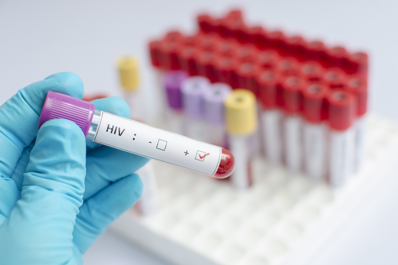 Жители Марий Эл могут бесплатно провериться на ВИЧ