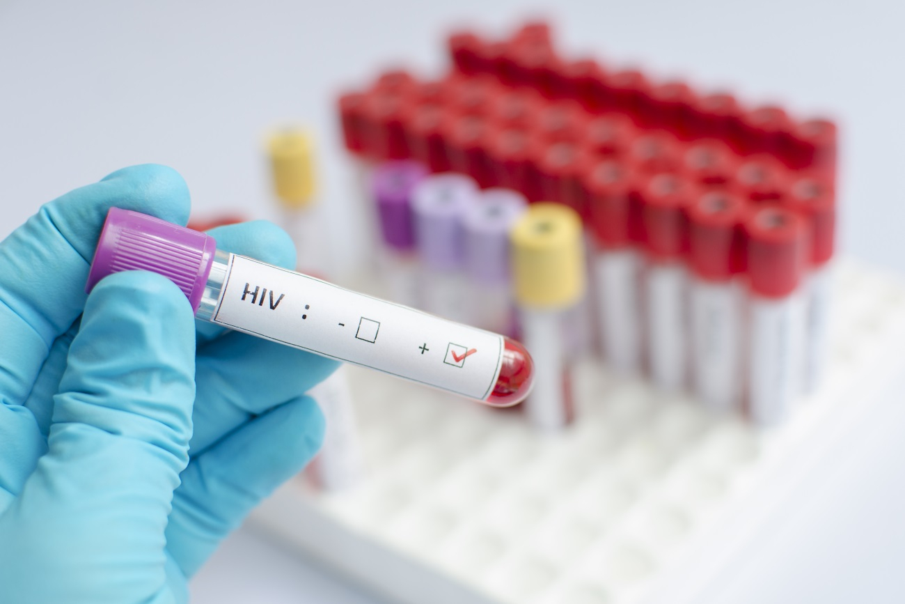 В субботу йошкаролинцы бесплатно проверят ВИЧ-статус