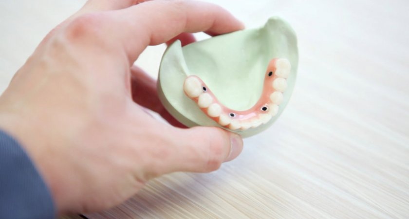 Имплантация зубов в Белоруссии