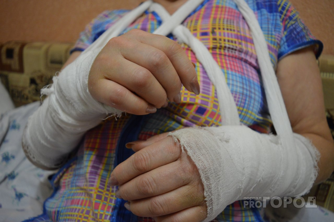 Более 20 йошкаролинцев оказались с переломами в травмпункте из-за гололеда