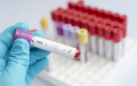 Жители Марий Эл могут бесплатно провериться на ВИЧ