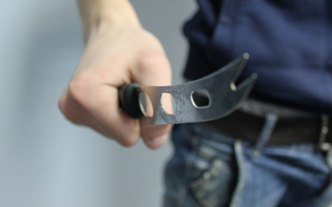 Жительница Марий Эл, раненая ножом в живот, доехала до больницы на такси