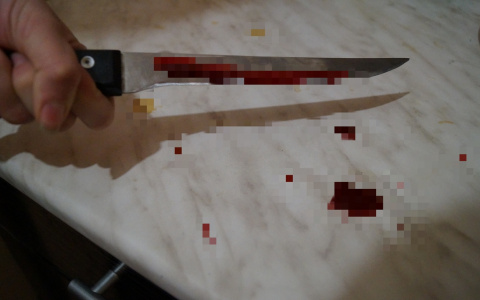 Житель Марий Эл, раненый ножом, разгуливал по поселку несколько часов