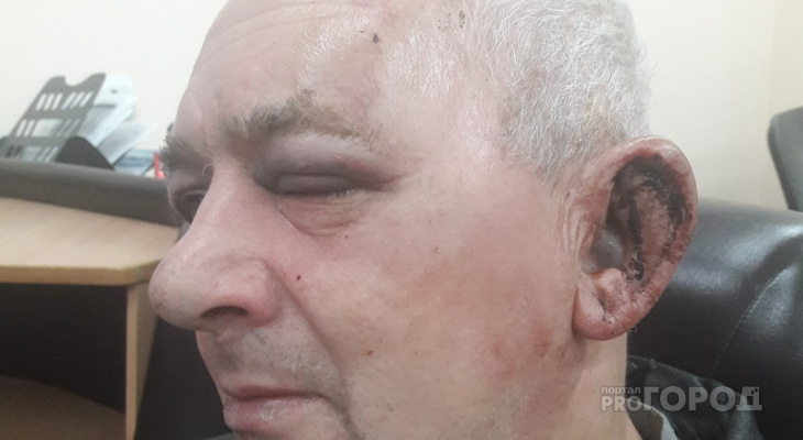 В Йошкар-Оле парень в маршрутке избил гармониста