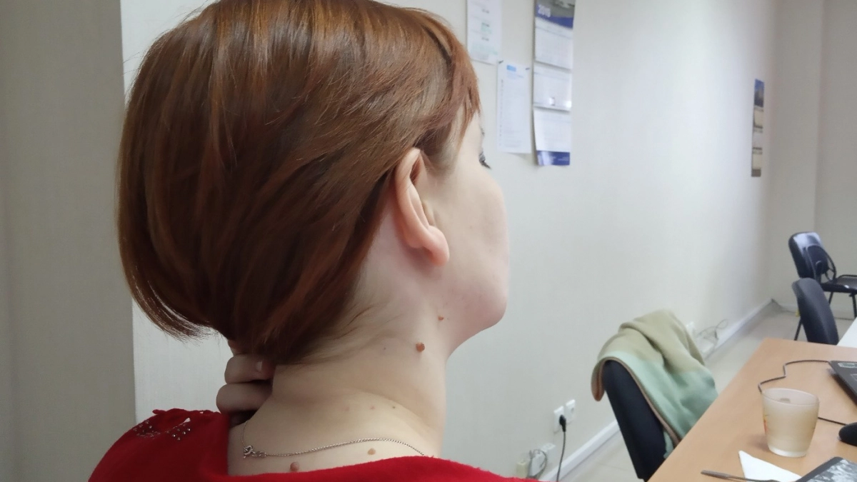 Откуда у здоровых людей звон в ушах и что это значит – запомните раз и навсегда