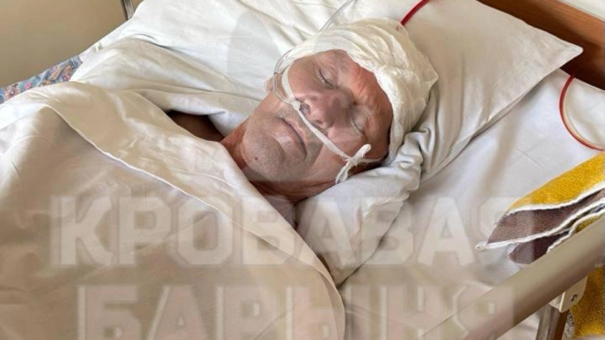 Родственники избитого жителя Силикатного прячут машины из-за слежки: виновник до сих пор на свободе