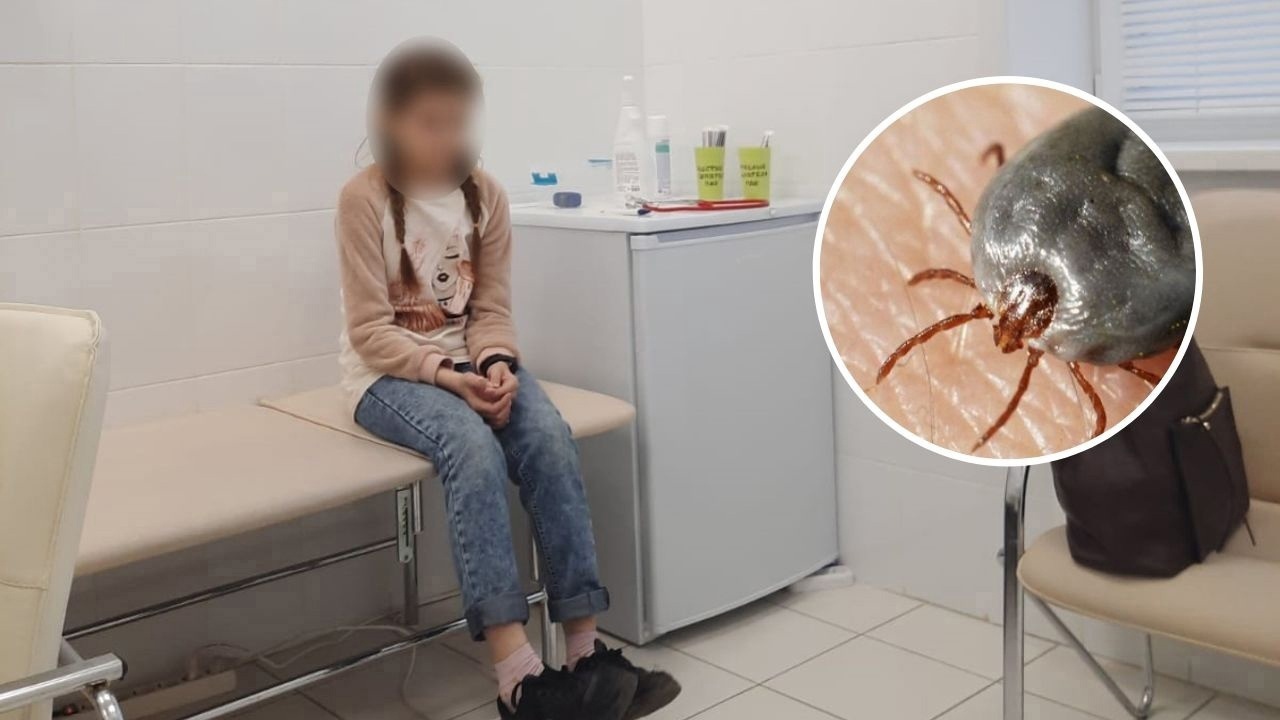 В Марий Эл 54 ребенка пострадали от укусов клещей
